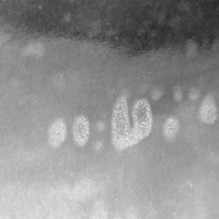 Particle